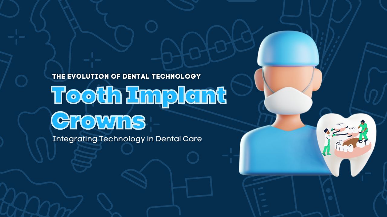 Tooth Implant Crowns